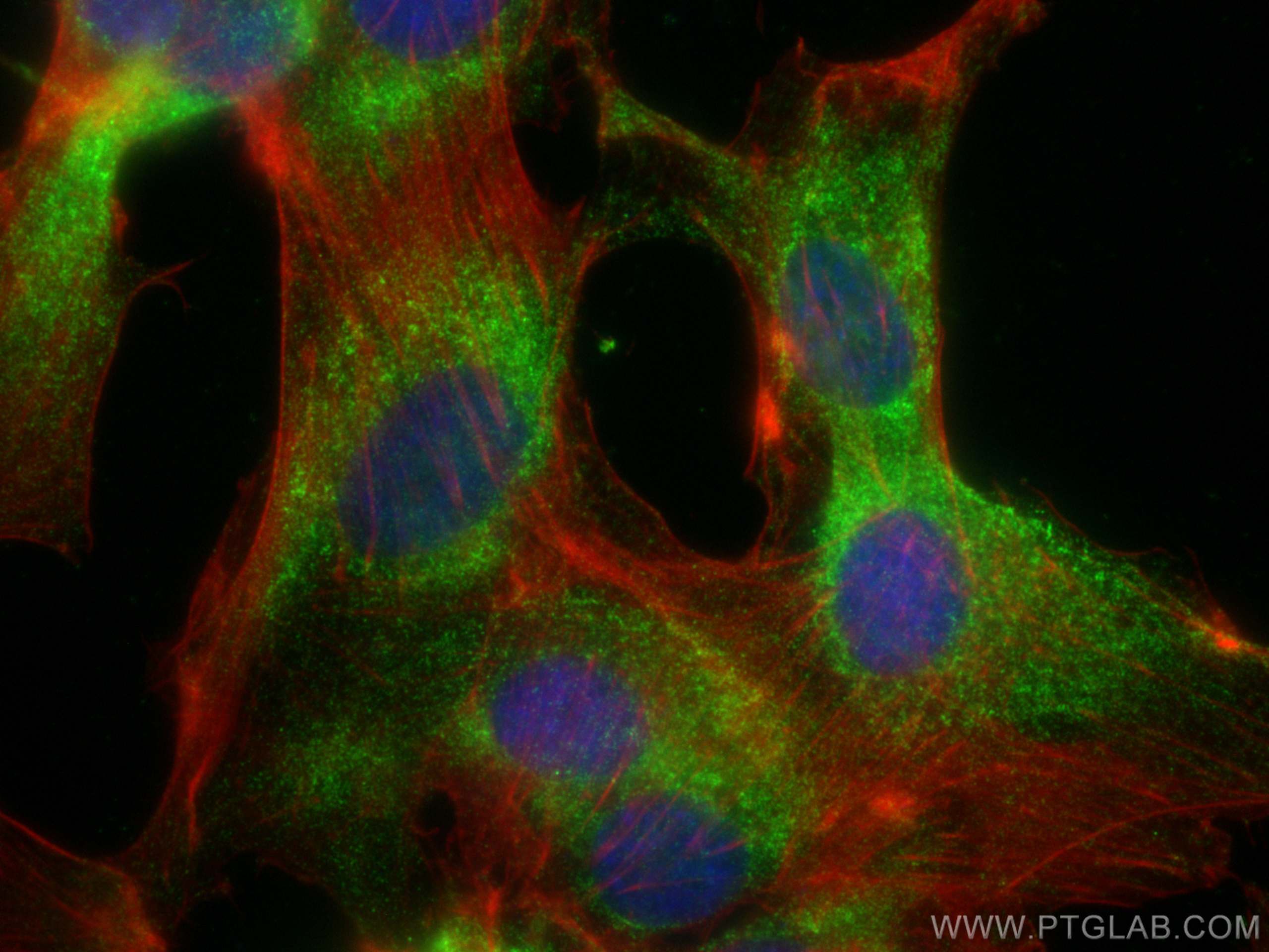 Immunofluorescence (IF) / fluorescent staining of U-87 MG cells using VAMP2 Monoclonal antibody (67822-1-Ig)