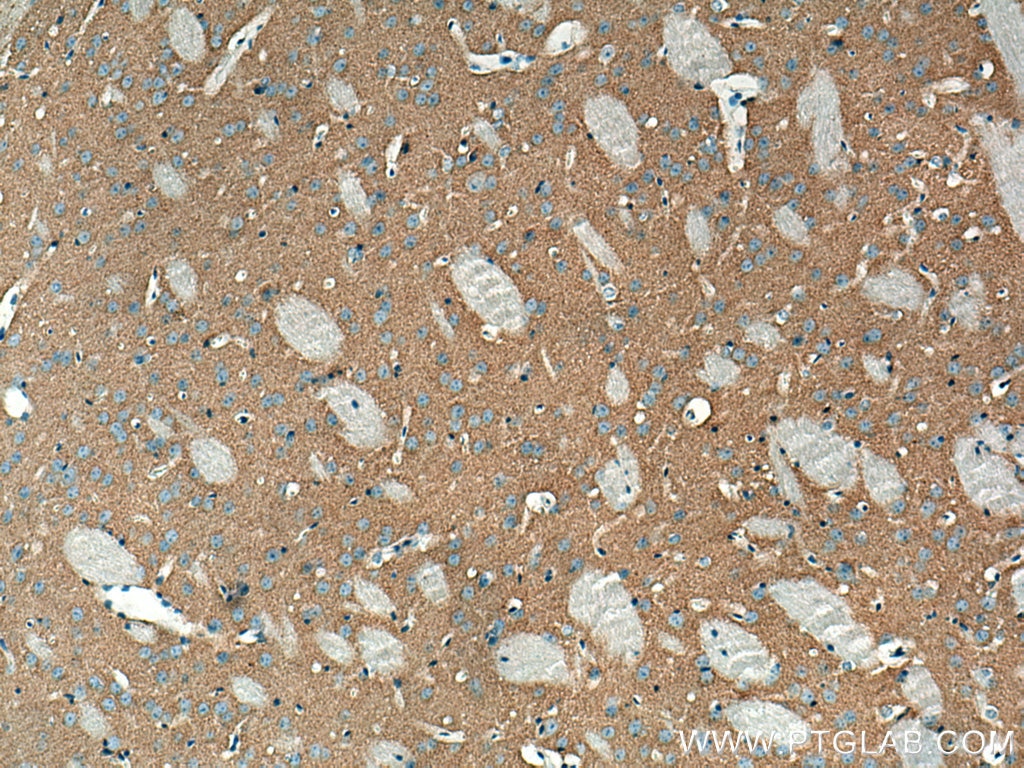 Immunohistochemistry (IHC) staining of mouse brain tissue using VAMP2 Monoclonal antibody (67822-1-Ig)