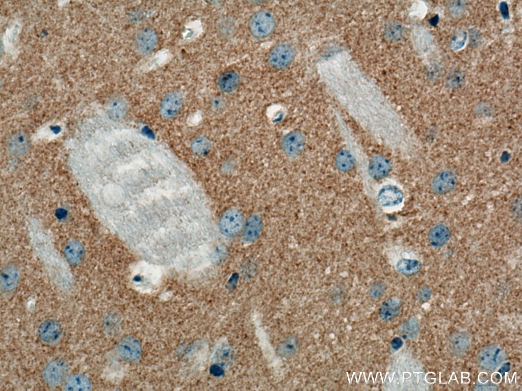 Immunohistochemistry (IHC) staining of mouse brain tissue using VAMP2 Monoclonal antibody (67822-1-Ig)