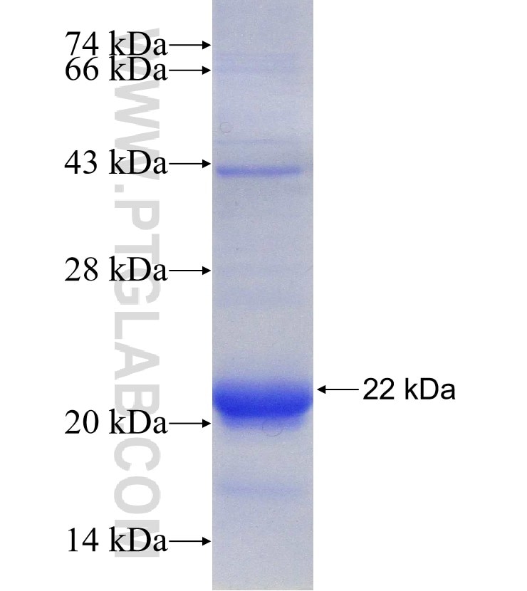 VAMP2 fusion protein Ag17908 SDS-PAGE
