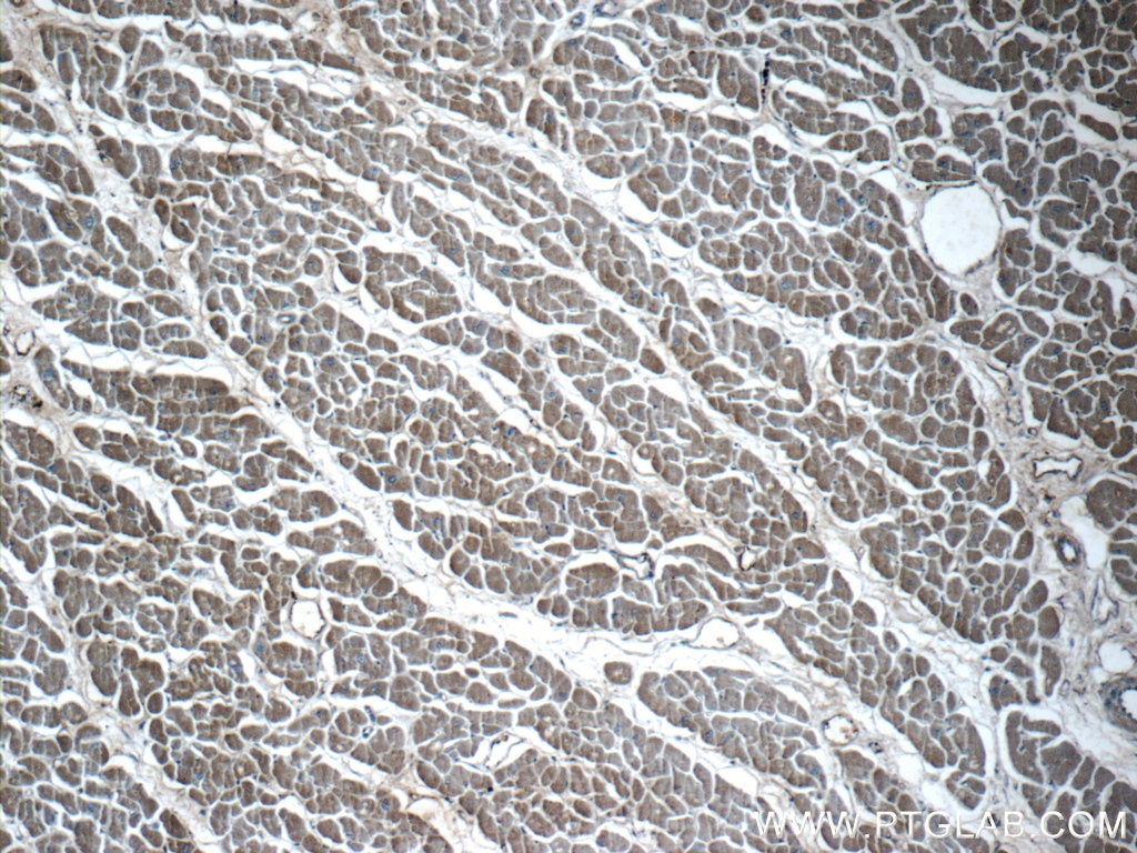 Immunohistochemistry (IHC) staining of human heart tissue using VAMP3/Cellubrevin Polyclonal antibody (10702-1-AP)