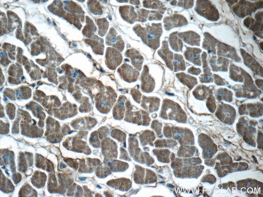 Immunohistochemistry (IHC) staining of human heart tissue using VAMP3/Cellubrevin Polyclonal antibody (10702-1-AP)