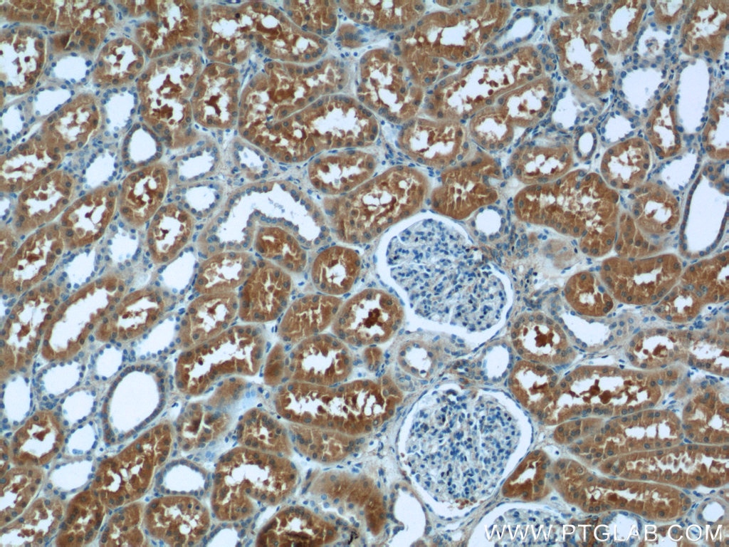 IHC staining of human kidney using 10702-1-AP