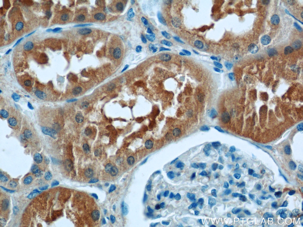 Immunohistochemistry (IHC) staining of human kidney tissue using VAMP3/Cellubrevin Polyclonal antibody (10702-1-AP)