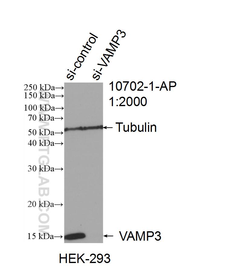 Western Blot (WB) analysis of HEK-293 cells using VAMP3/Cellubrevin Polyclonal antibody (10702-1-AP)