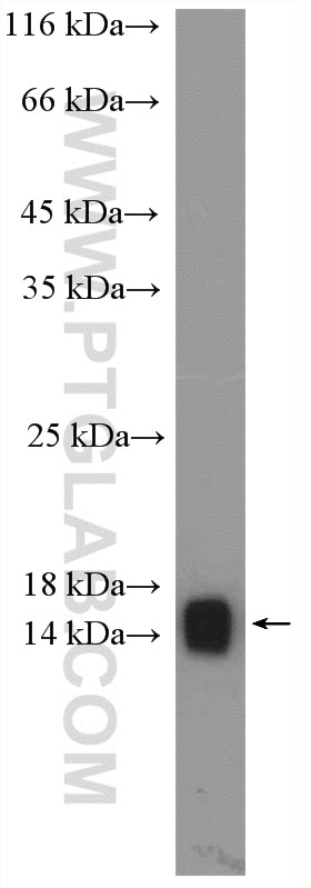 Western Blot (WB) analysis of HEK-293 cells using VAMP3/Cellubrevin Polyclonal antibody (10702-1-AP)