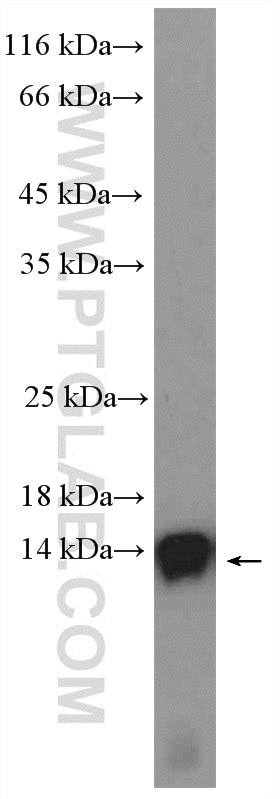 Western Blot (WB) analysis of MCF-7 cells using VAMP3/Cellubrevin Polyclonal antibody (10702-1-AP)