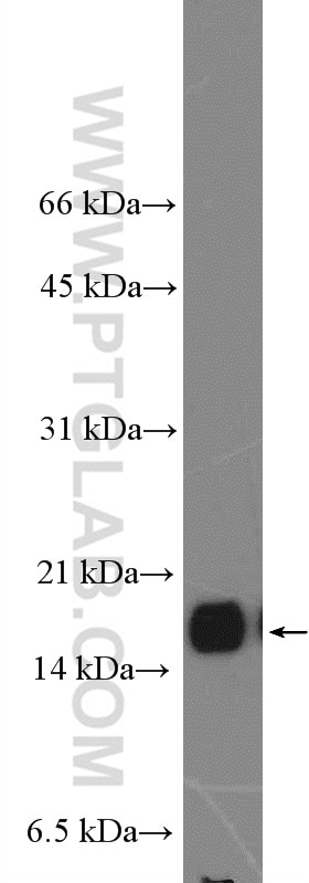 WB analysis of mouse brain using 10702-1-AP