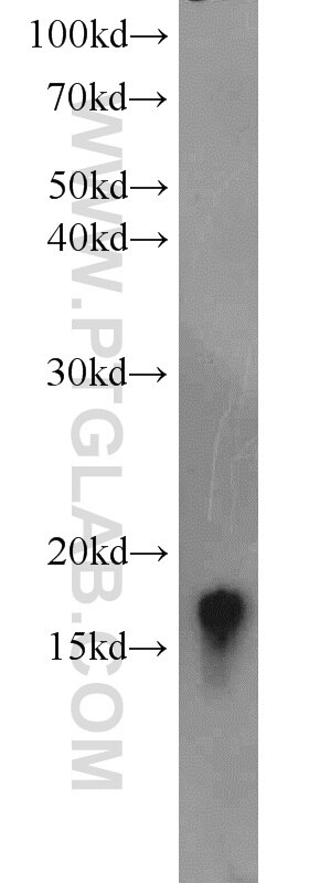 VAMP3/Cellubrevin Polyclonal antibody