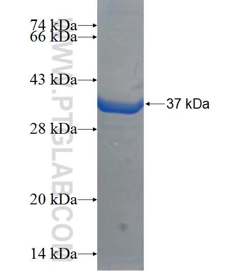 VAMP3 fusion protein Ag1156 SDS-PAGE