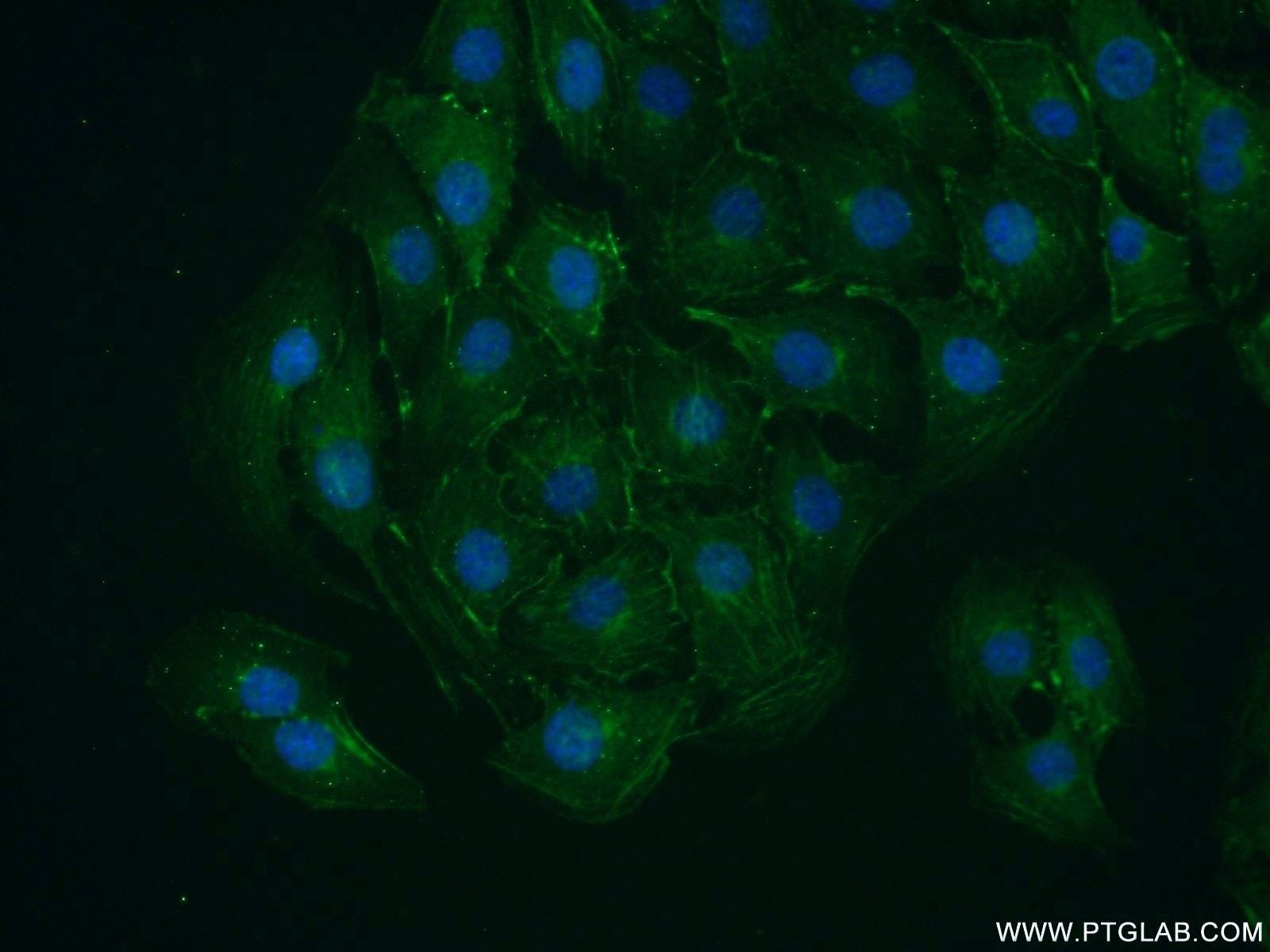 Immunofluorescence (IF) / fluorescent staining of SH-SY5Y cells using VAMP4 Polyclonal antibody (10738-1-AP)
