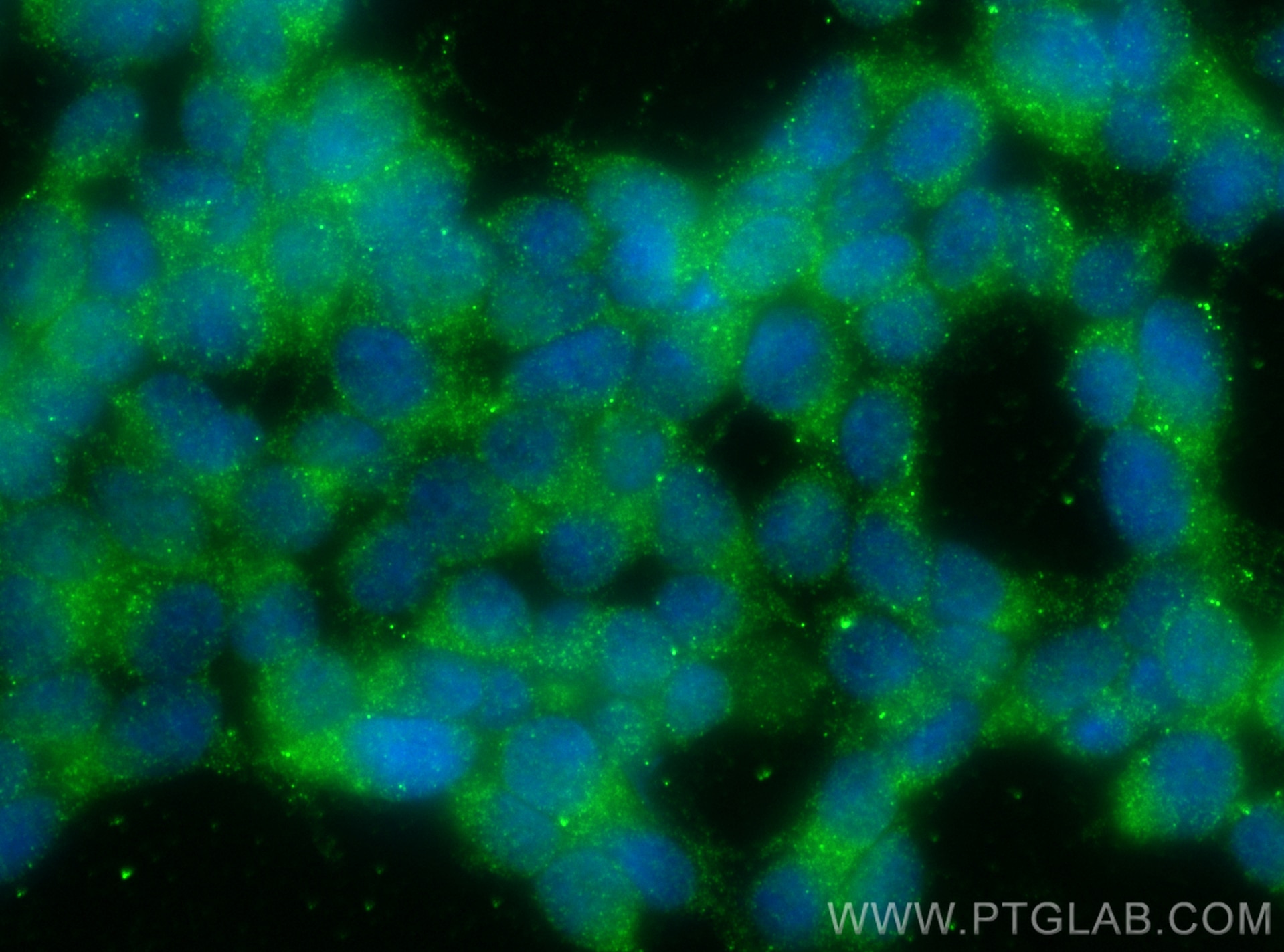 Immunofluorescence (IF) / fluorescent staining of SH-SY5Y cells using VAMP4 Polyclonal antibody (10738-1-AP)