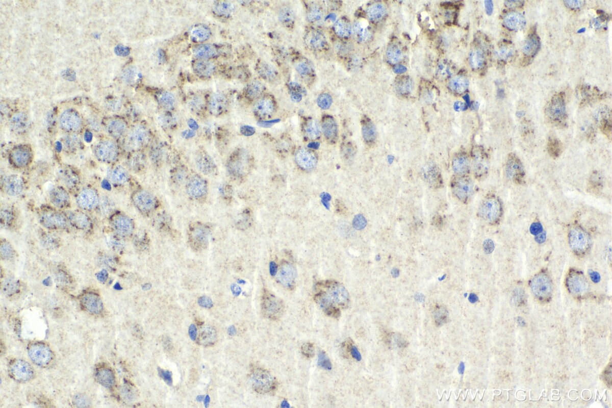 Immunohistochemistry (IHC) staining of rat brain tissue using VAMP4 Polyclonal antibody (10738-1-AP)