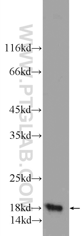 Western Blot (WB) analysis of mouse brain tissue using VAMP4 Polyclonal antibody (10738-1-AP)