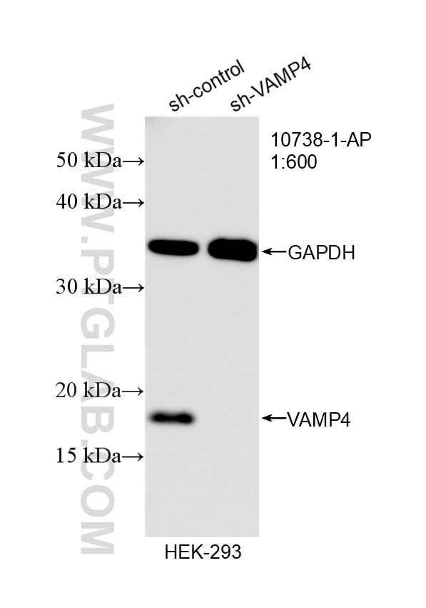 Western Blot (WB) analysis of HEK-293 cells using VAMP4 Polyclonal antibody (10738-1-AP)