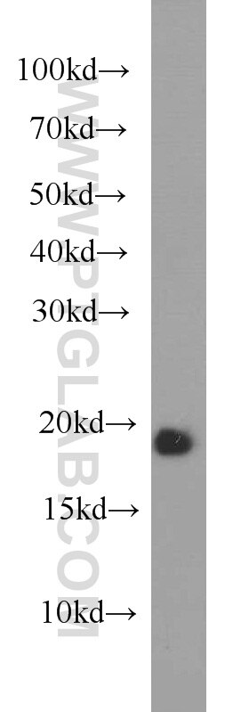 Western Blot (WB) analysis of mouse brain tissue using VAMP4 Polyclonal antibody (10738-1-AP)