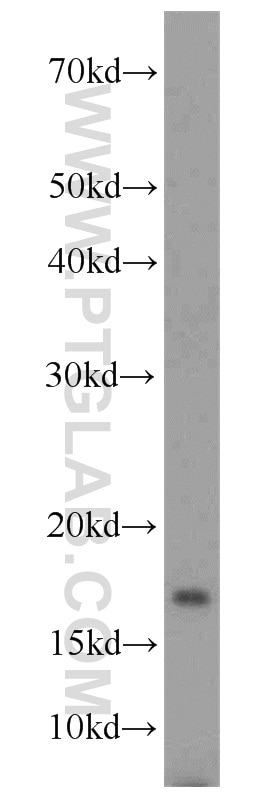 WB analysis of SH-SY5Y using 10738-1-AP