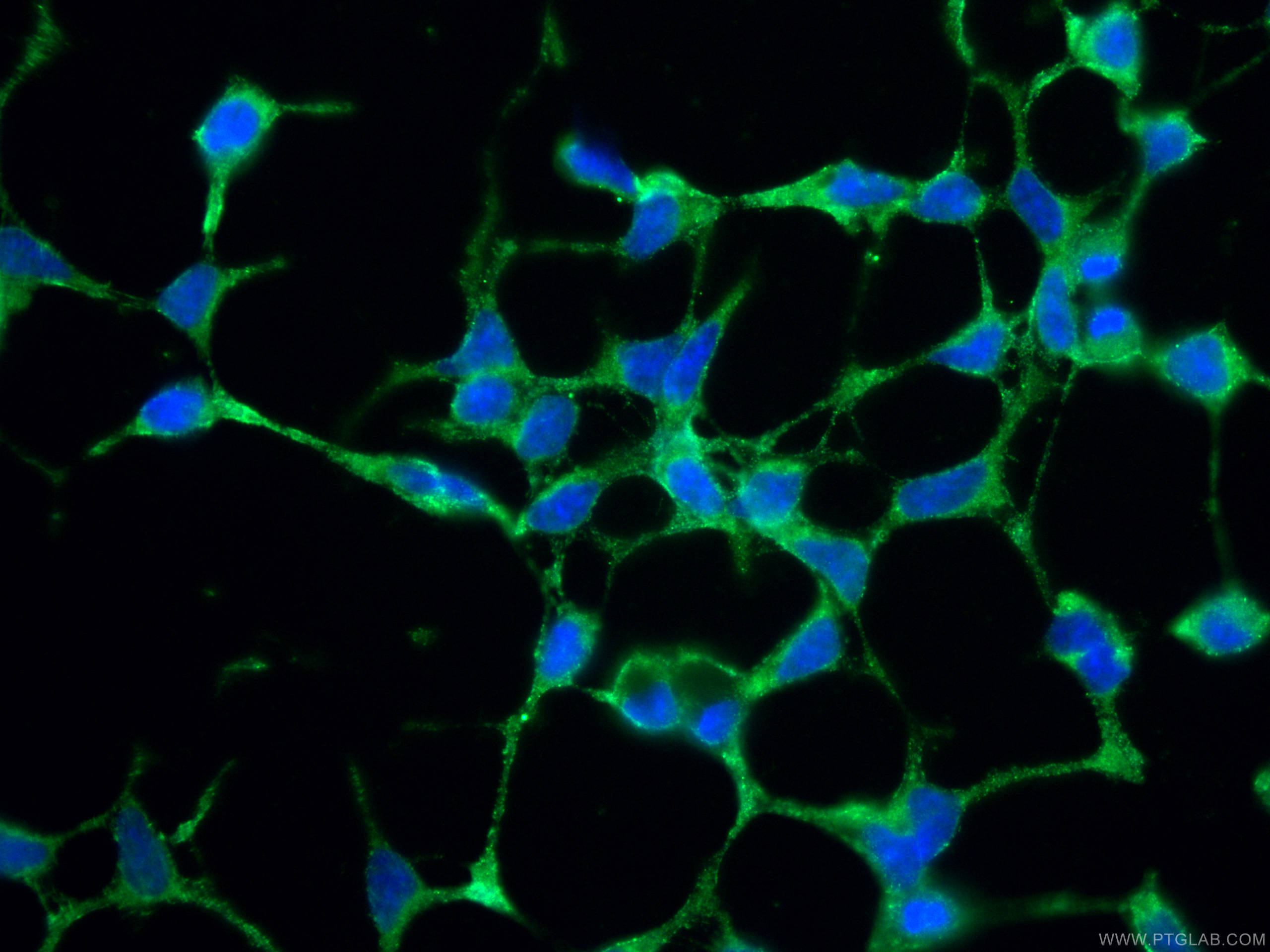 Immunofluorescence (IF) / fluorescent staining of HEK-293 cells using VAMP4 Monoclonal antibody (67219-1-Ig)