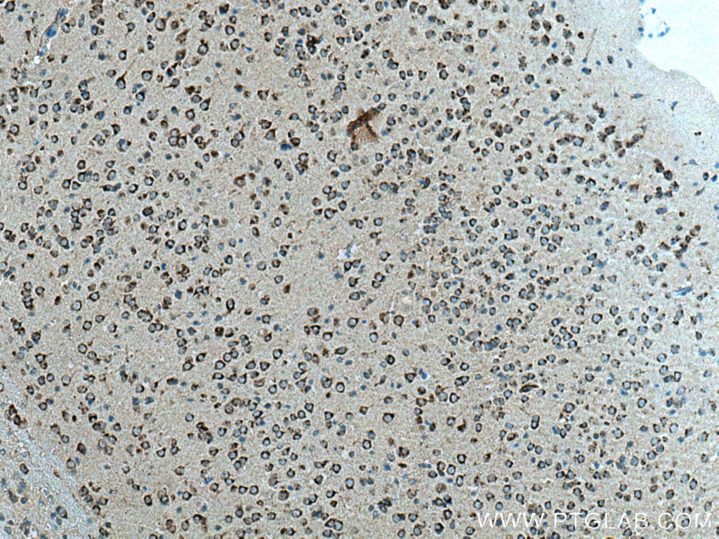 Immunohistochemistry (IHC) staining of mouse brain tissue using VAMP4 Monoclonal antibody (67219-1-Ig)