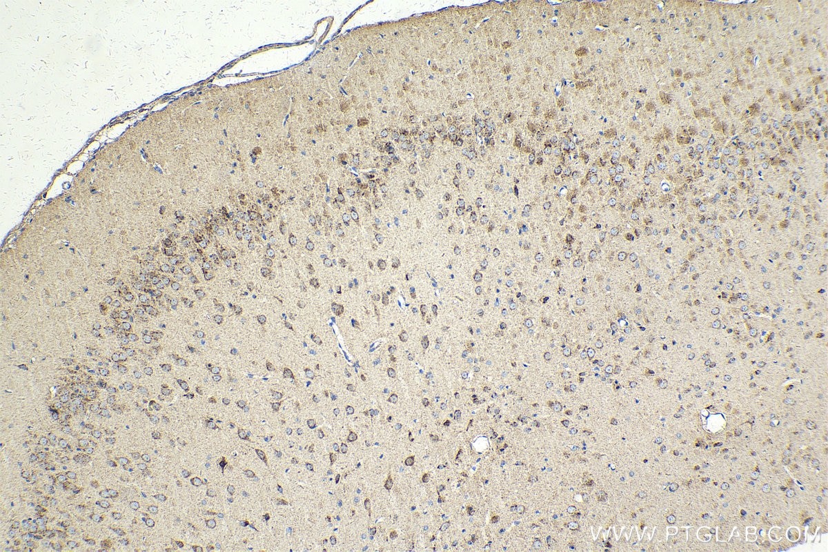 Immunohistochemistry (IHC) staining of rat brain tissue using VAMP4 Monoclonal antibody (67219-1-Ig)
