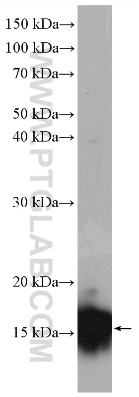 Western Blot (WB) analysis of human peripheral blood leukocyte using VAMP5 Polyclonal antibody (11822-1-AP)