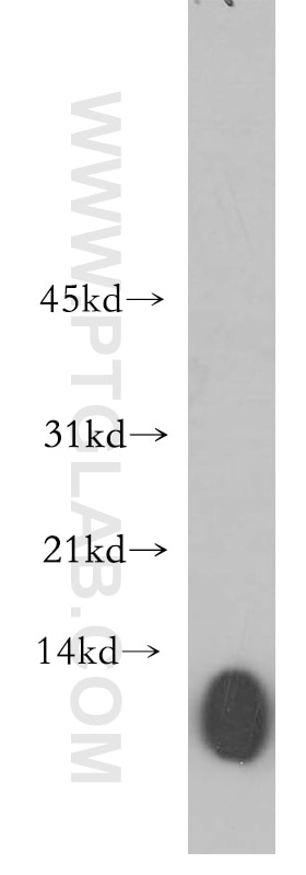 WB analysis of human lung using 11822-1-AP