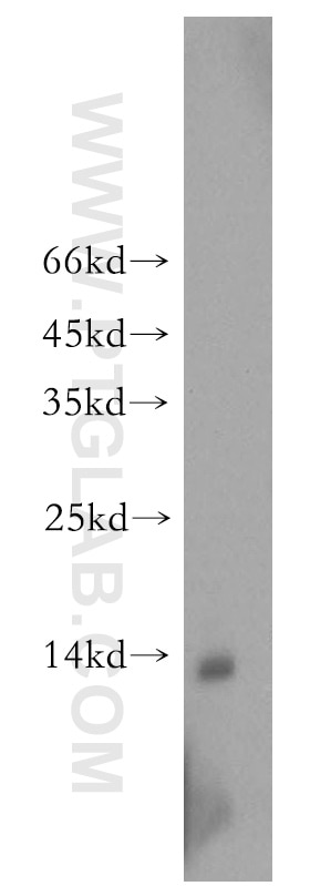 Western Blot (WB) analysis of mouse kidney tissue using VAMP5 Polyclonal antibody (11822-1-AP)