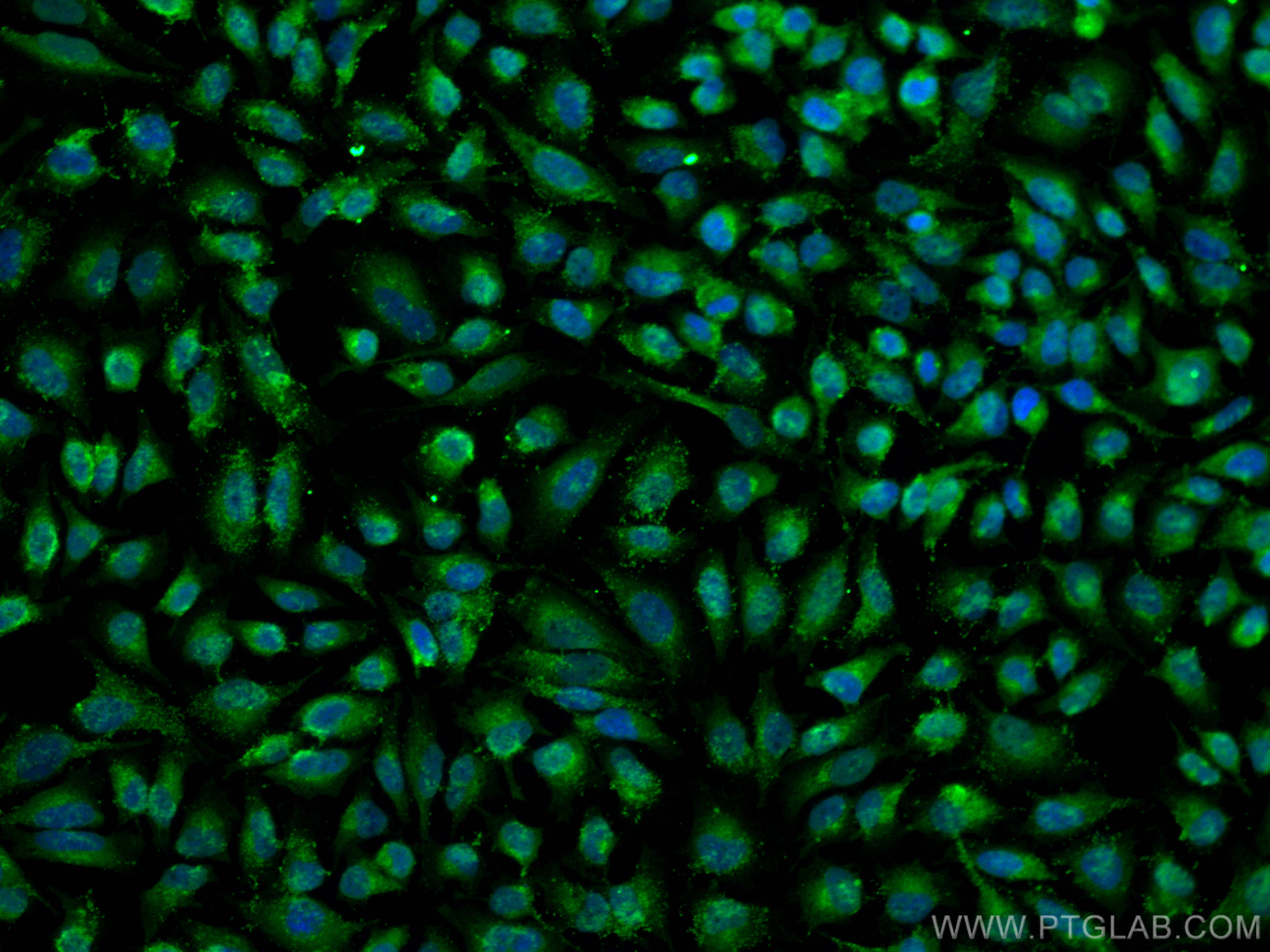 Immunofluorescence (IF) / fluorescent staining of HeLa cells using VAMP7/TI-VAMP Polyclonal antibody (22268-1-AP)