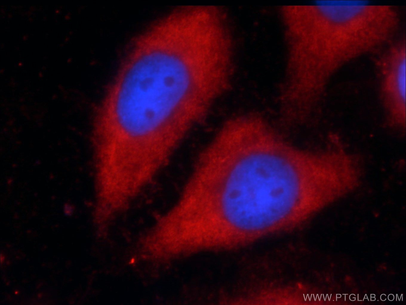 Immunofluorescence (IF) / fluorescent staining of HepG2 cells using VAMP7/TI-VAMP Polyclonal antibody (22268-1-AP)
