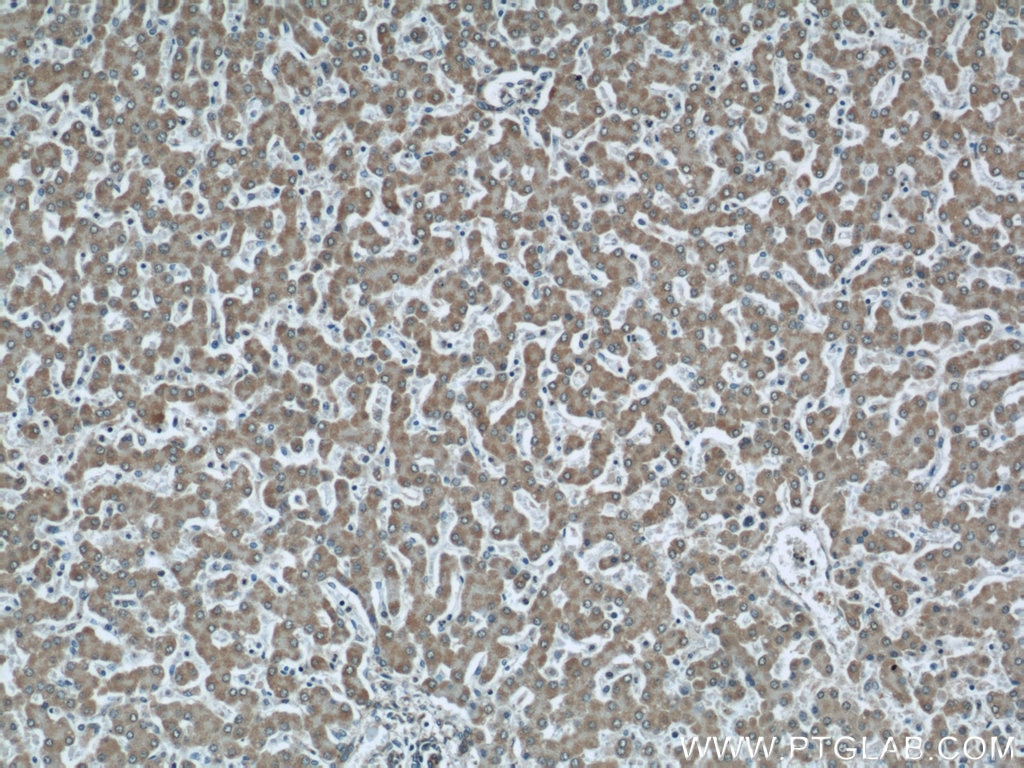 Immunohistochemistry (IHC) staining of human liver tissue using VAMP7/TI-VAMP Polyclonal antibody (22268-1-AP)