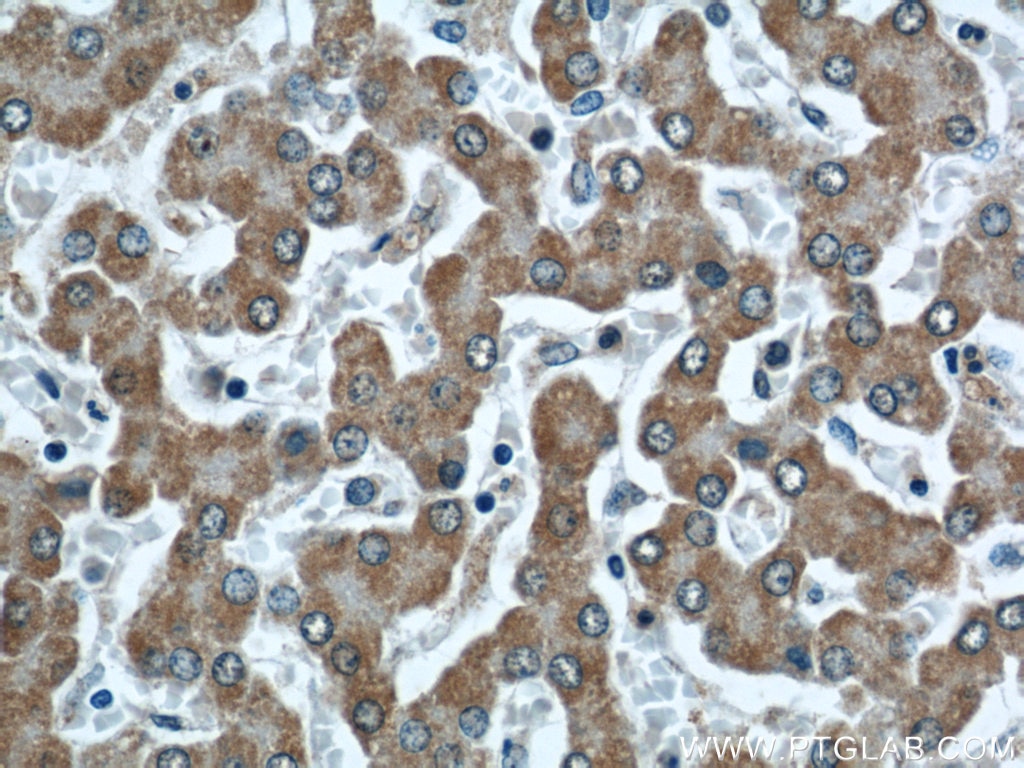 Immunohistochemistry (IHC) staining of human liver tissue using VAMP7/TI-VAMP Polyclonal antibody (22268-1-AP)