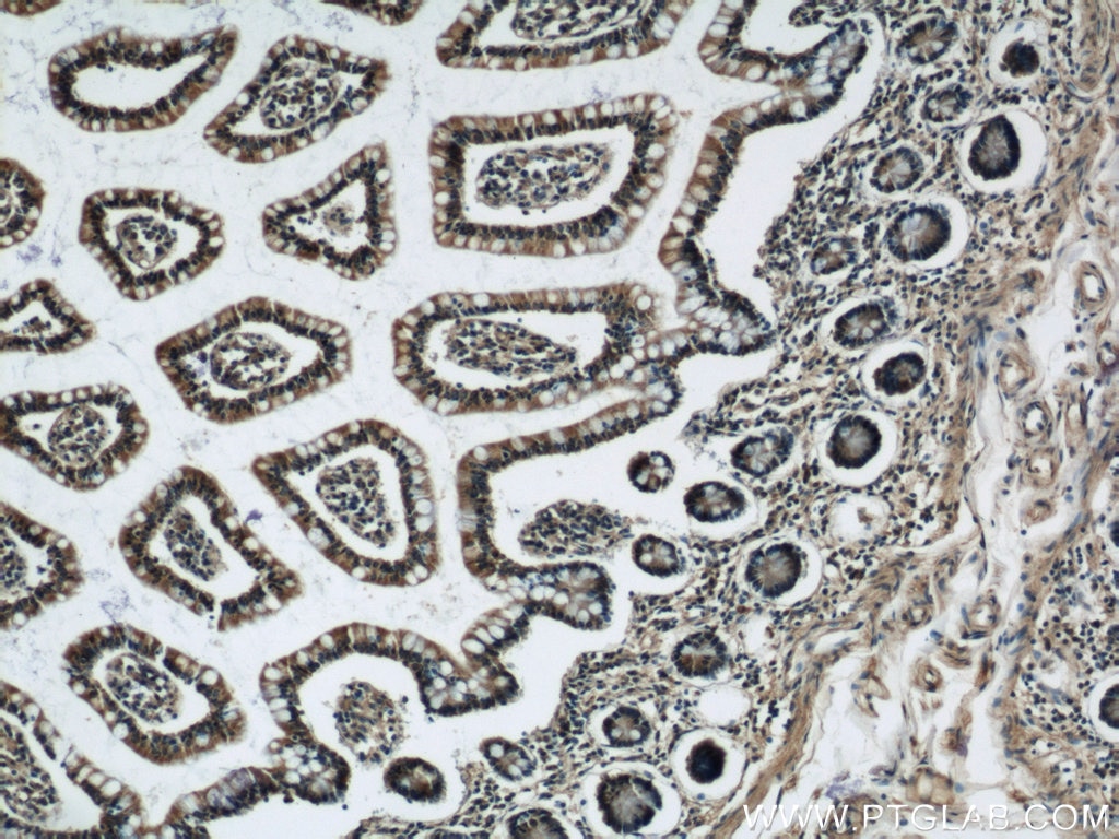 Immunohistochemistry (IHC) staining of human small intestine tissue using VAMP7/TI-VAMP Polyclonal antibody (22268-1-AP)