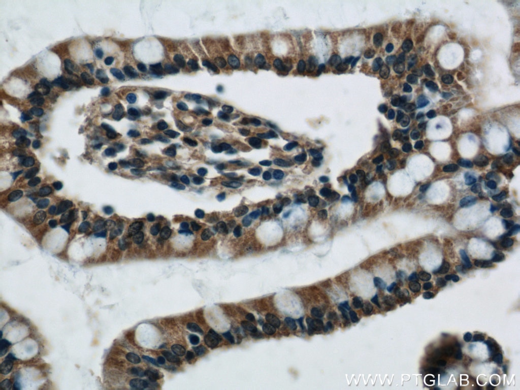 Immunohistochemistry (IHC) staining of human small intestine tissue using VAMP7/TI-VAMP Polyclonal antibody (22268-1-AP)