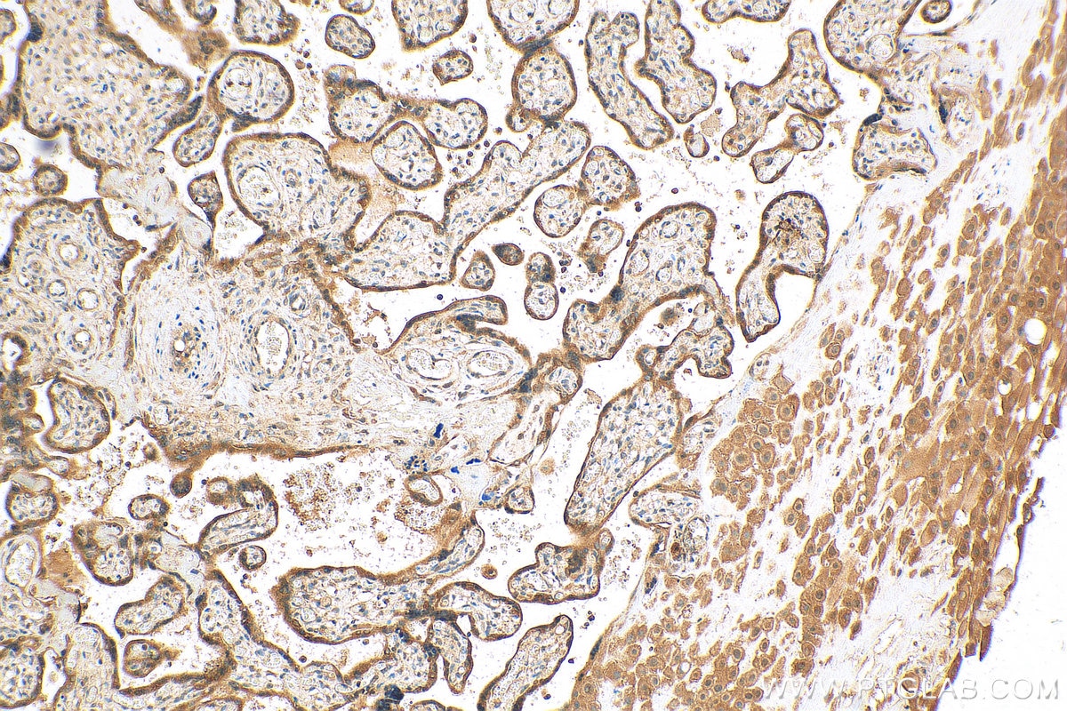 Immunohistochemistry (IHC) staining of human placenta tissue using VAMP8 Polyclonal antibody (15546-1-AP)