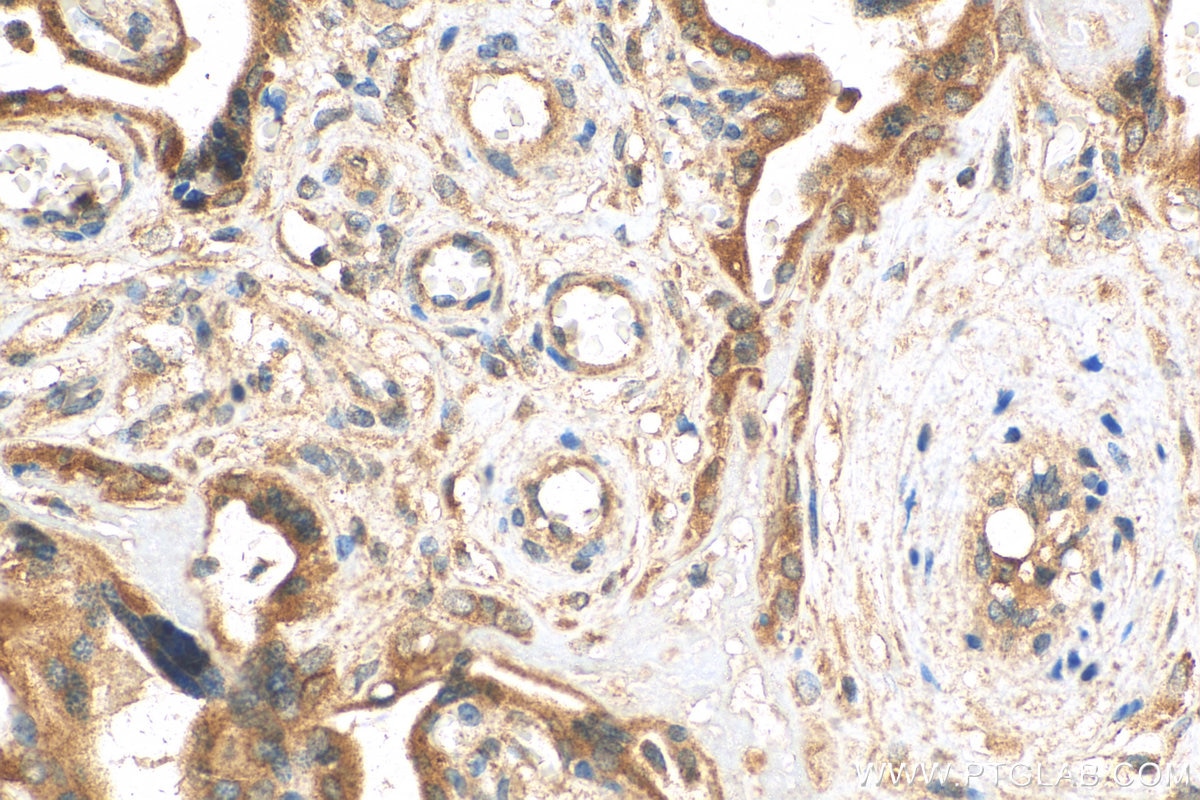 Immunohistochemistry (IHC) staining of human placenta tissue using VAMP8 Polyclonal antibody (15546-1-AP)