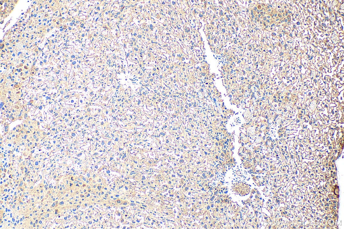 Immunohistochemistry (IHC) staining of mouse placenta tissue using VAMP8 Polyclonal antibody (15546-1-AP)