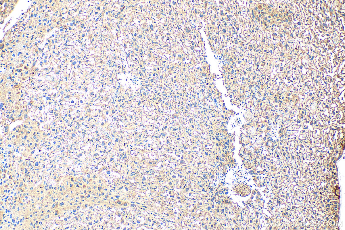 IHC staining of mouse placenta using 15546-1-AP