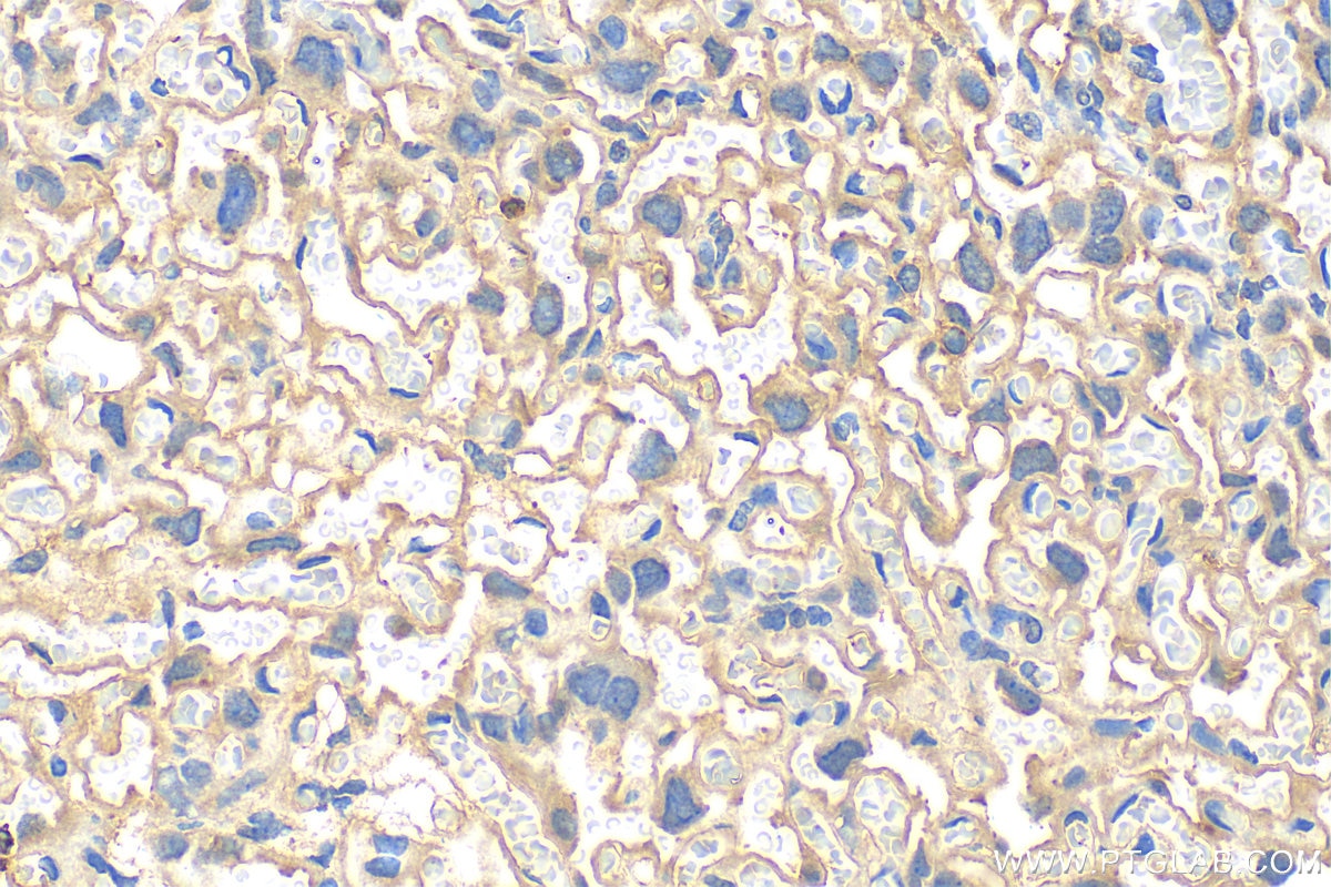 Immunohistochemistry (IHC) staining of mouse placenta tissue using VAMP8 Polyclonal antibody (15546-1-AP)