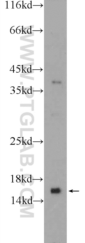 VAMP8 Polyclonal antibody