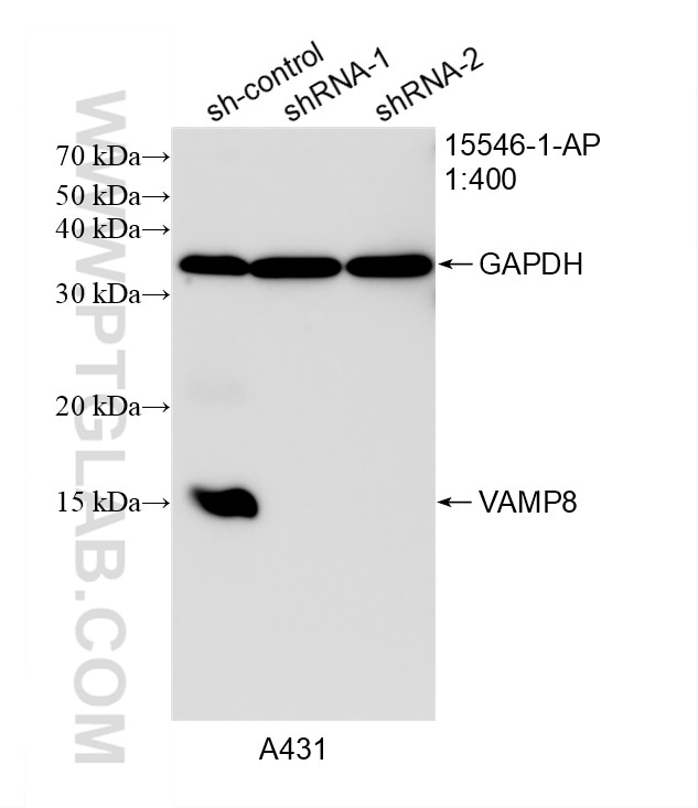Western Blot (WB) analysis of A431 cells using VAMP8 Polyclonal antibody (15546-1-AP)