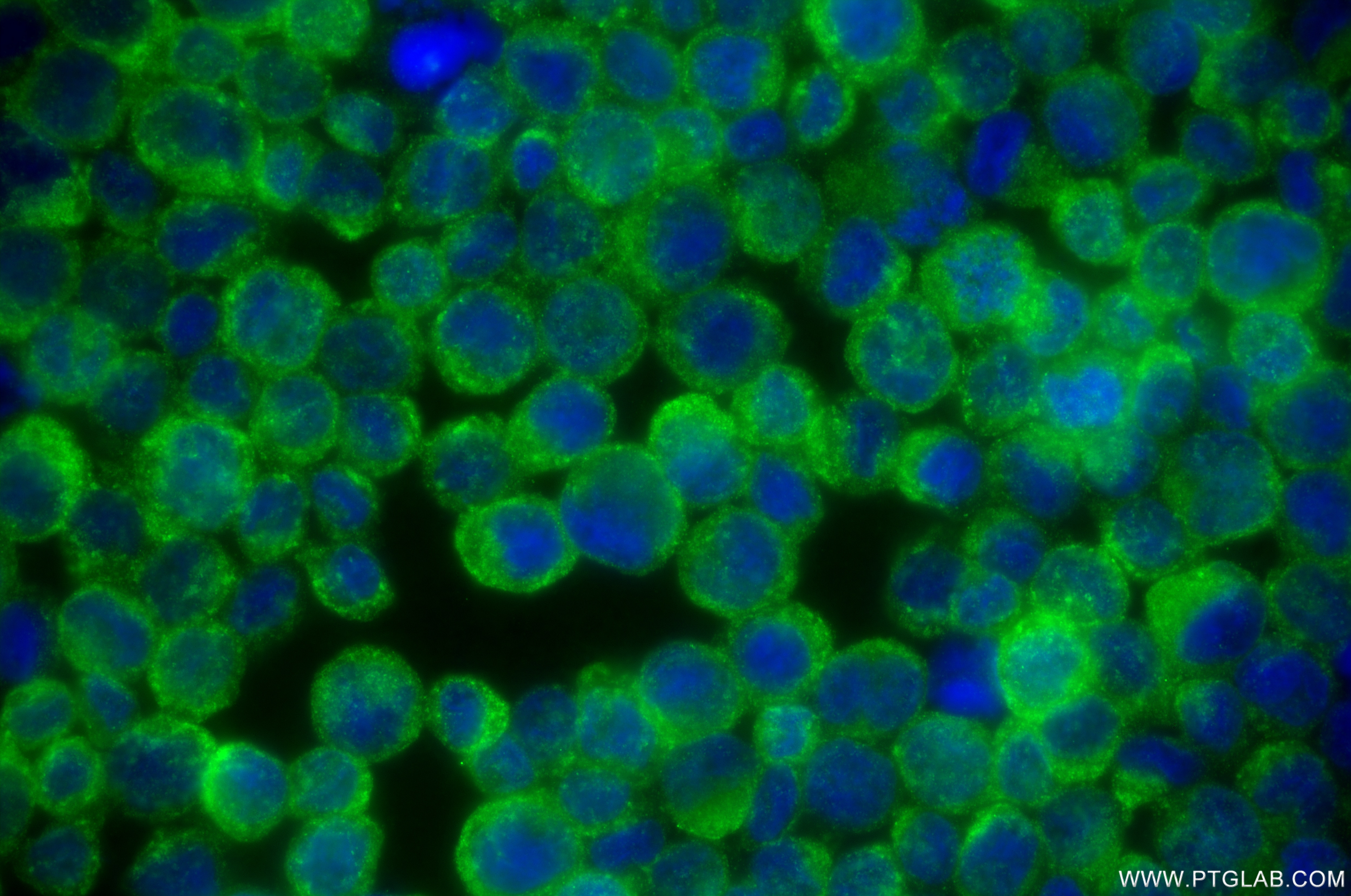 Immunofluorescence (IF) / fluorescent staining of THP-1 cells using VAMP8 Recombinant antibody (85400-4-RR)