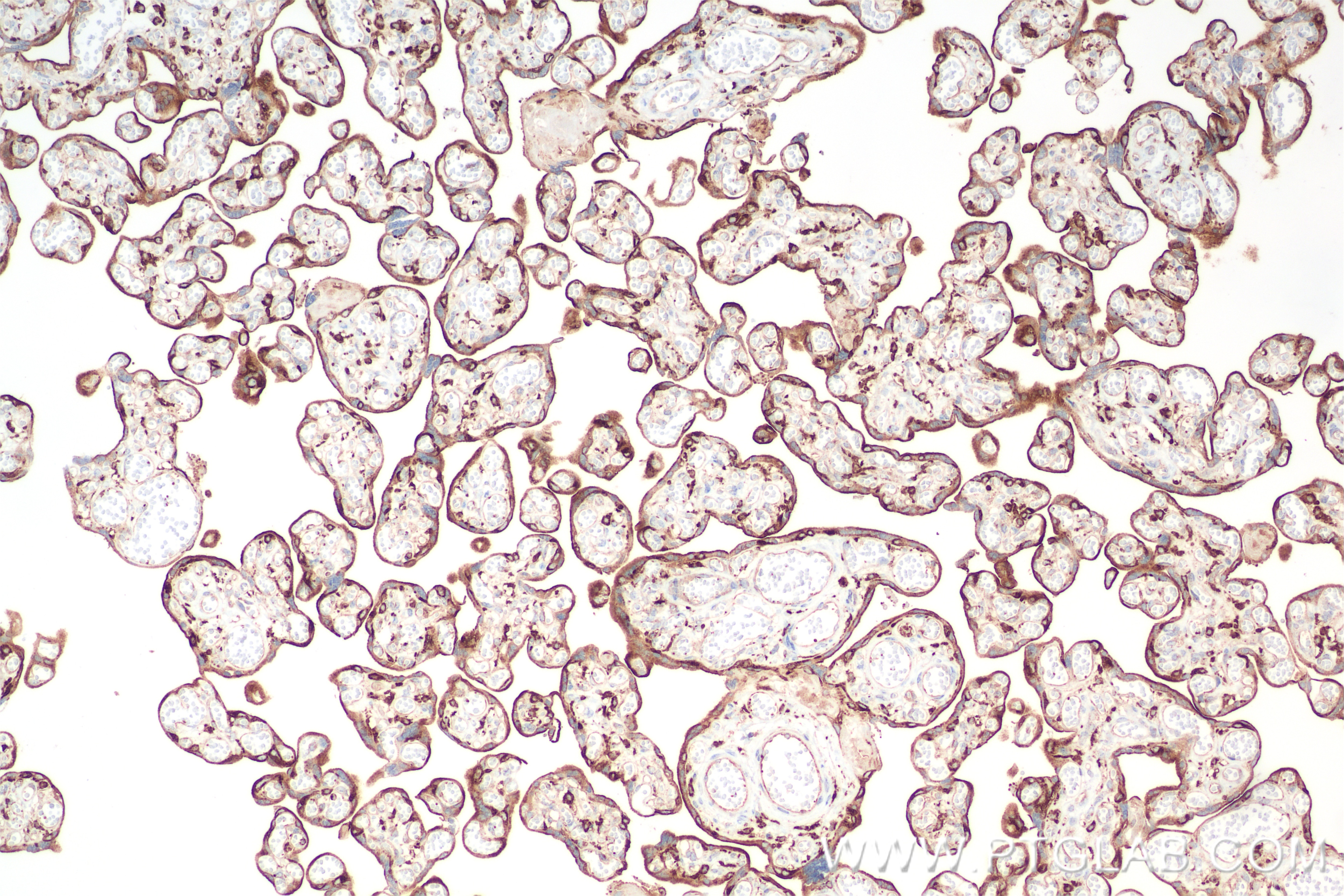 Immunohistochemistry (IHC) staining of human placenta tissue using VAMP8 Recombinant antibody (85400-4-RR)