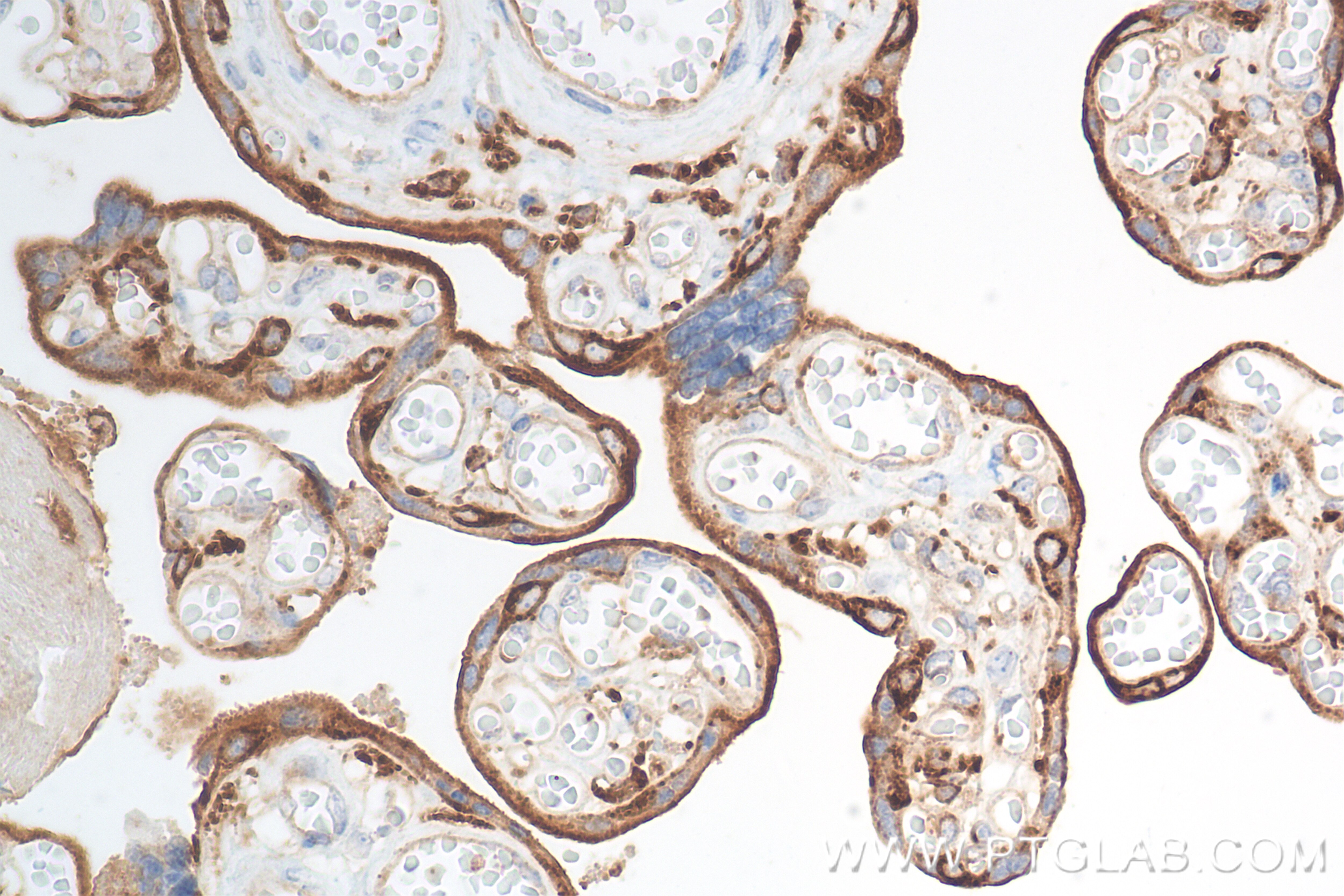 Immunohistochemistry (IHC) staining of human placenta tissue using VAMP8 Recombinant antibody (85400-4-RR)