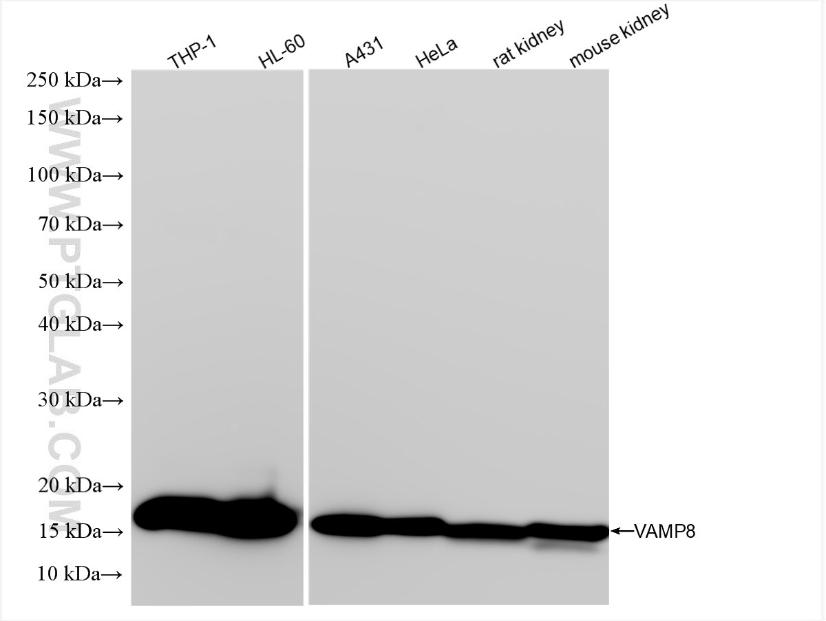 Western Blot (WB) analysis of various lysates using VAMP8 Recombinant antibody (85400-4-RR)