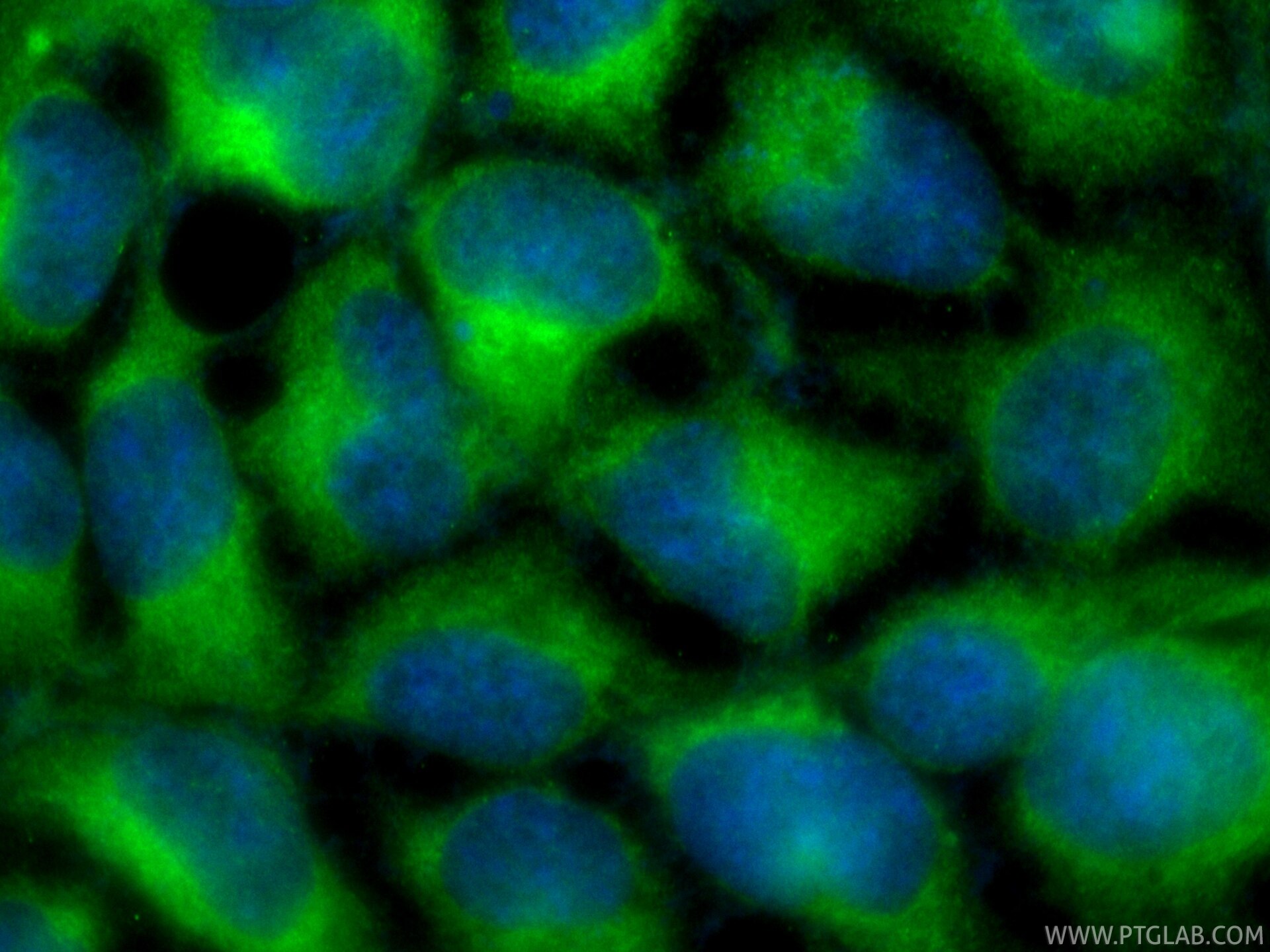 Immunofluorescent analysis of (-20°C Ethanol) fixed HEK-293 cells using CoraLite® Plus 488 VAMP8 antibody (CL488-85400-4, Clone: 242830B11 ) at dilution of 1:200. Immunofluorescence (IF) / fluorescent staining of HEK-293 cells using CoraLite® Plus 488-conjugated VAMP8 Recombinant mo (CL488-85400-4)