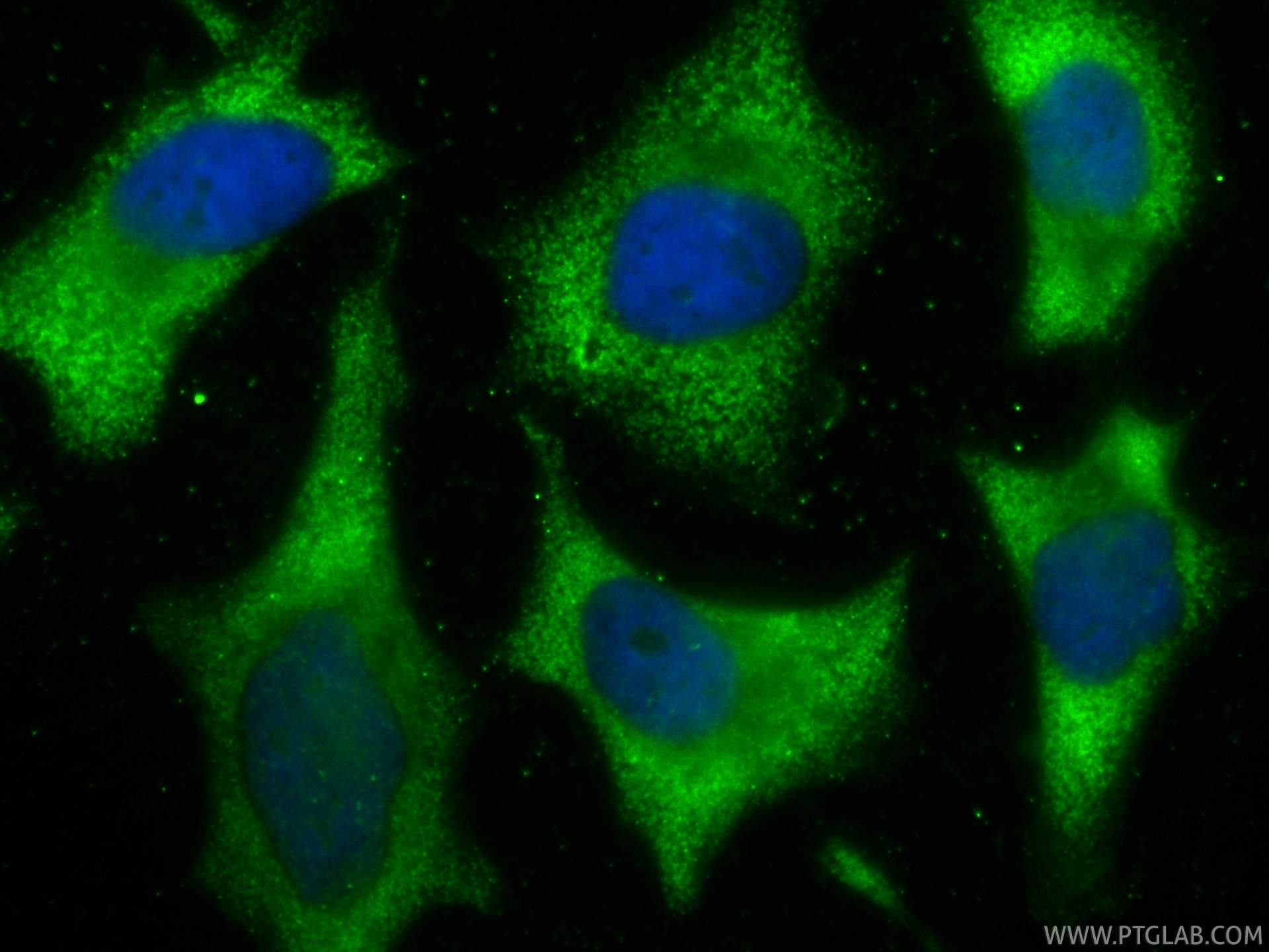 Immunofluorescent analysis of (-20°C Ethanol) fixed HeLa cells using CoraLite® Plus 488 VAMP8 antibody (CL488-85400-4, Clone: 242830B11 ) at dilution of 1:200. Immunofluorescence (IF) / fluorescent staining of HeLa cells using CoraLite® Plus 488-conjugated VAMP8 Recombinant mo (CL488-85400-4)