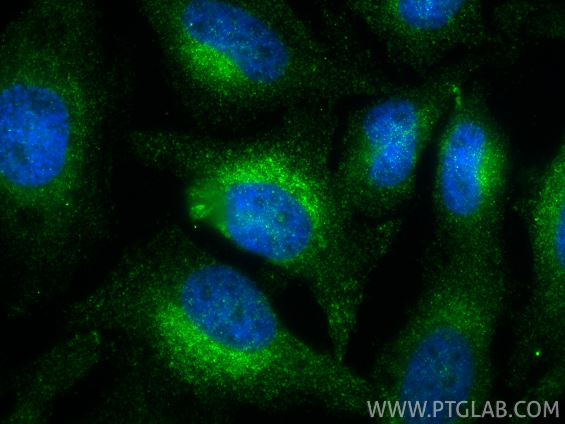 Immunofluorescence (IF) / fluorescent staining of HeLa cells using Multi-rAb® VAMP8 Multi-Recombinant antibody (RMX00044)