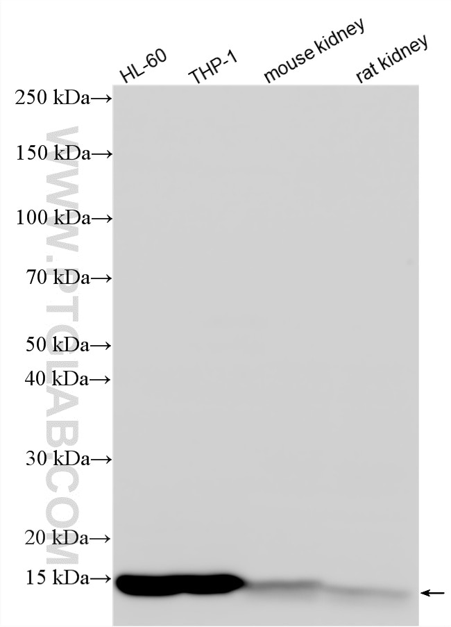 Western Blot (WB) analysis of various lysates using Multi-rAb® VAMP8 Multi-Recombinant antibody (RMX00044)