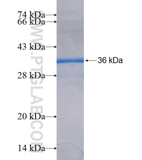 VAMP8 fusion protein Ag7903 SDS-PAGE