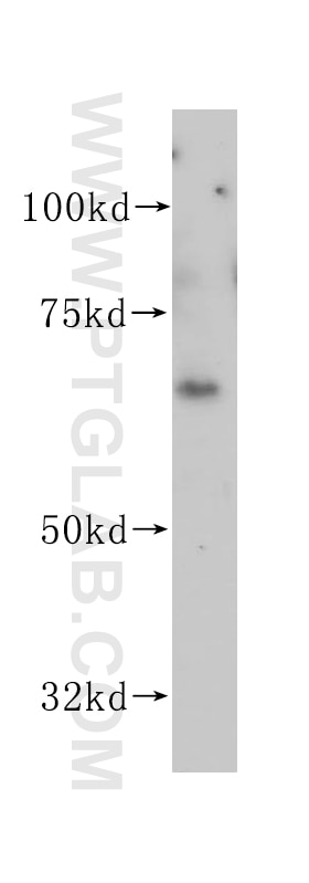 VANGL1 Polyclonal antibody